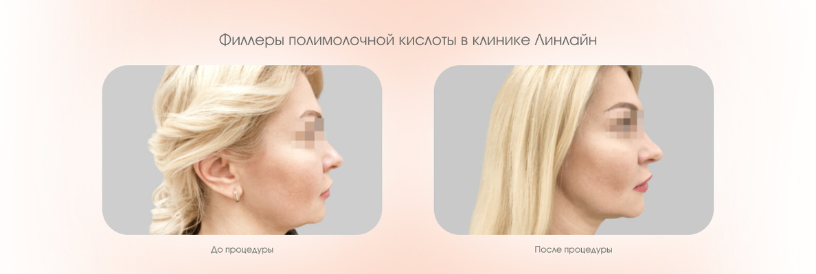 bc122aa5-c6ef-4ed9-b2ca-1b7215057563.JPG
